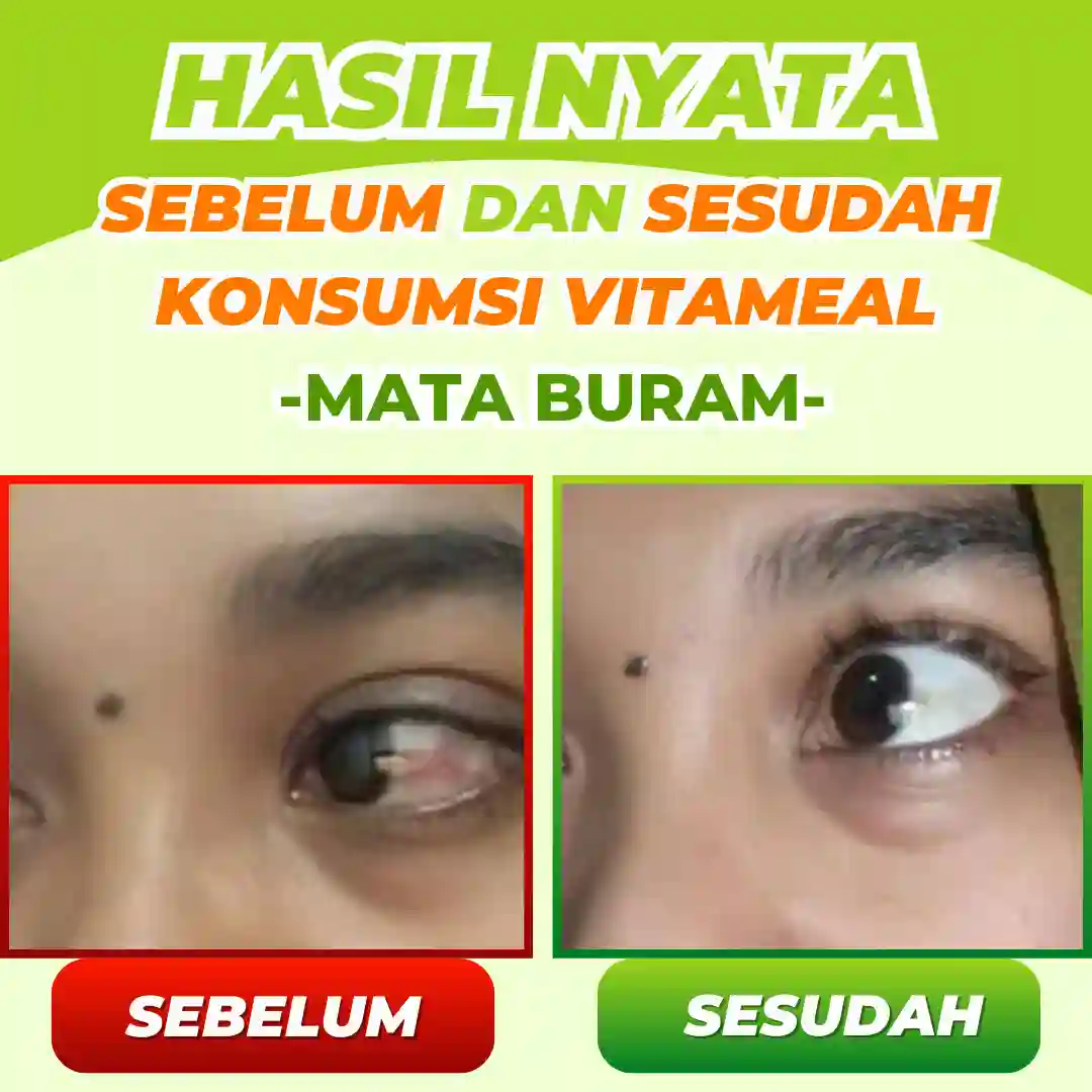 testi mata